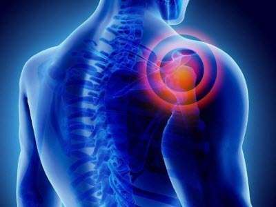 Shoulder Pain Treatment