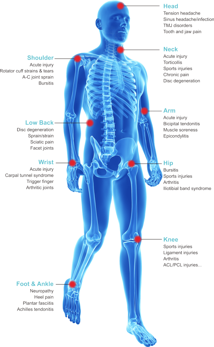 class iv laser pain relief class iv laser pain relief