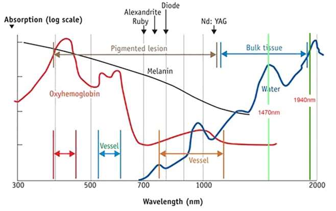 Absorption and Wavelength of EVLT Laser Absorption and Wavelength of EVLT Laser