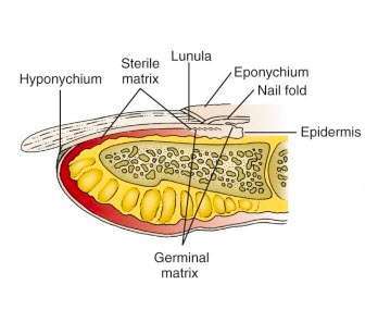Treat Nail Fungus Treat Nail Fungus