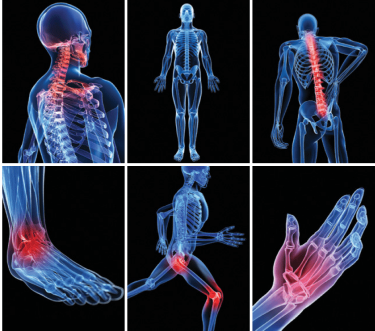 pain relief laser pain relief laser