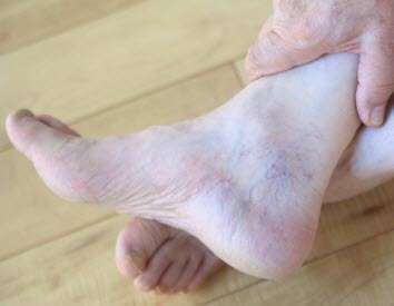 Foot Small Vascular Veins Foot Small Vascular Veins