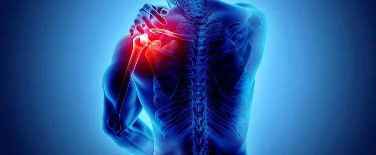 Shoulder Pain Shoulder Pain